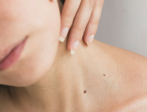 La pell també lluita: com cuidar-la durant els tractaments oncològics