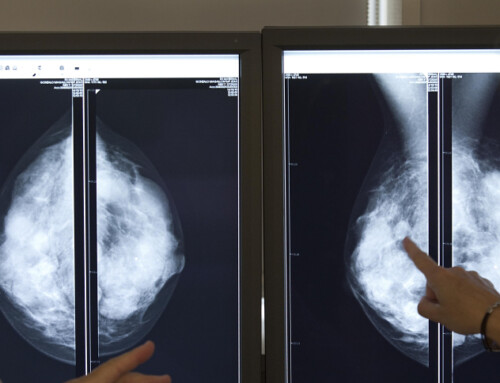 Así son los tiempos de espera en el cribado del cáncer de mama en Catalunya
