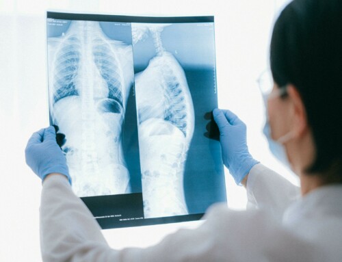 Jornada d’Oncolliga sobre els avenços en el càncer de pulmó: programes de detecció precoç i nous tractaments