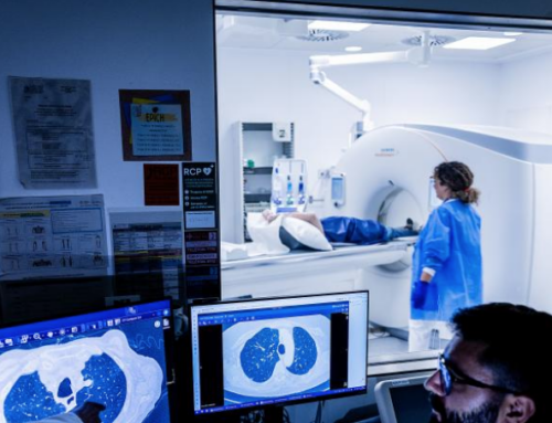 Catalunya ofrecerá la detección precoz del cáncer de pulmón a partir de 2027