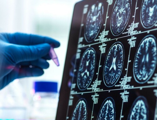 Científicos españoles descubren una vía para combatir la metástasis cerebral antes de que aparezcan los síntomas